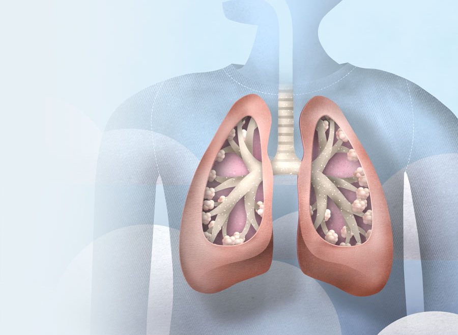 Respiratory Therapy and Rehabilitation